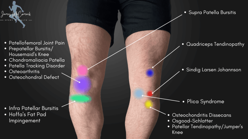 Knee pain Relief