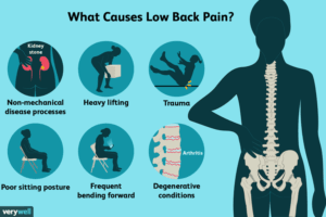 Back Pain Issues