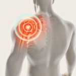 Rotator Cuff Pain
