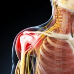 Shoulder Pain