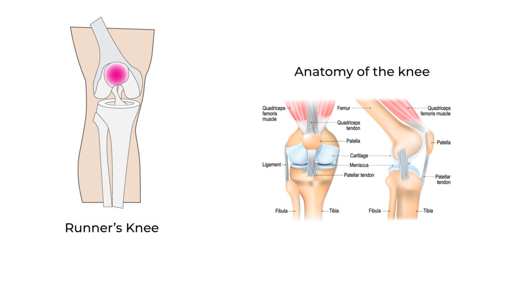 runner knee area of pain